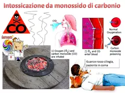 Quali sono i sintomi dell'avvelenamento da monossido di carbonio